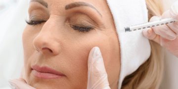 Botox Treatment – Top Important Things to consider