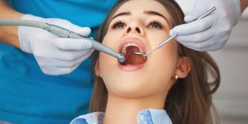 How to reduce Dental Treatments