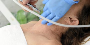 Four Medical Aesthetic Treatments for Acne