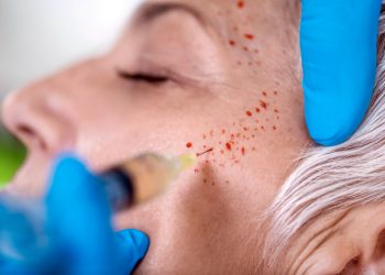 All About PRP Facials: Things Worth Knowing!