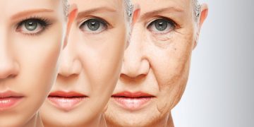 What are the benefits of RF Microneedling?