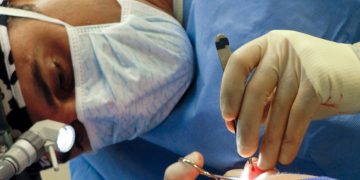 What Most People Want to Know About Nose Surgery