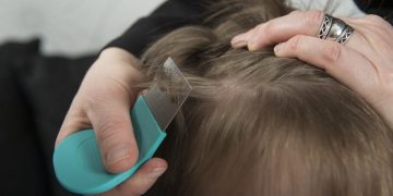 The Definitive Guide To Getting Rid Of Lice On Your Hair