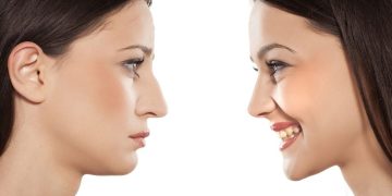 How Do I Find a Good Rhinoplasty Surgeon in Bangkok?