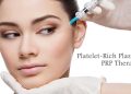 What You Need To Know About Platelet-Rich Plasma Therapy