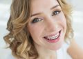 Why is it Never Too Late for Adult Braces?