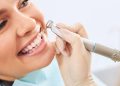 How Teeth Whitening Can Transform Your Smile?