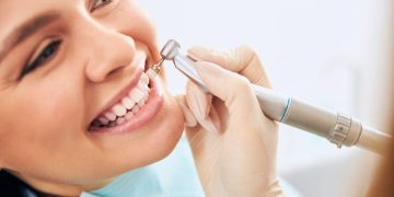 How Teeth Whitening Can Transform Your Smile? 