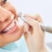 How Teeth Whitening Can Transform Your Smile?